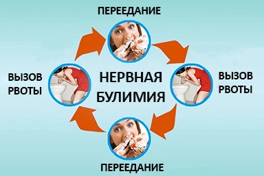 Лечение булимии в Похвистнево